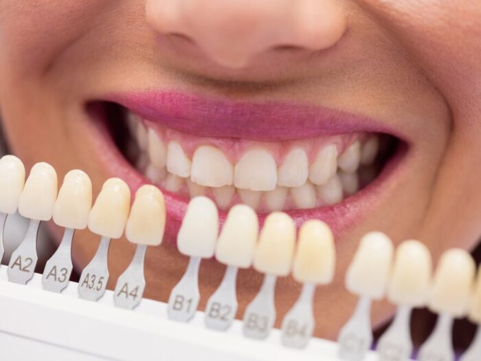 dentist-examining-female-patient-with-teeth-shades_107420-65412